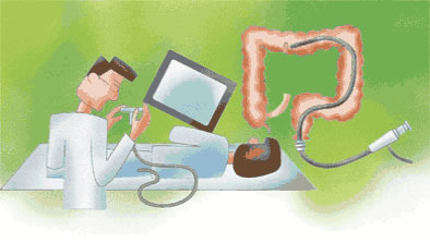 대장암의 검사 및 진단